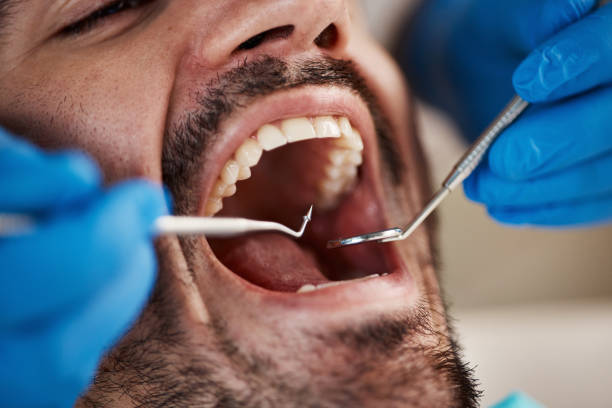 Best Tooth Infection Emergency Dentist  in Magnolia, OH